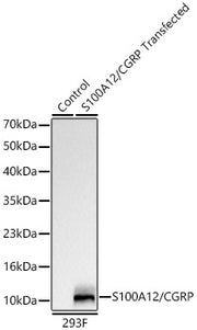 S100A12/CGRP Rabbit mAb