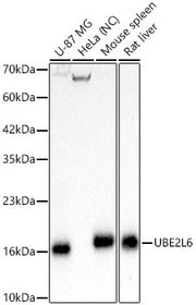 UBE2L6 Rabbit mAb