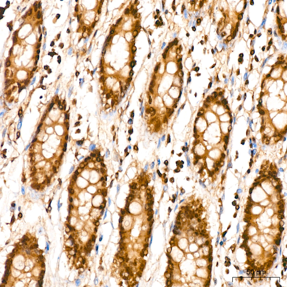 UBE2L6 Rabbit mAb