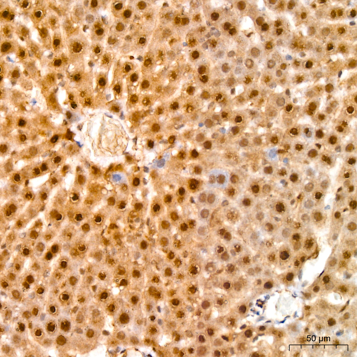 UBE2L6 Rabbit mAb