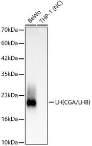 LH(CGA/LHB) Rabbit mAb