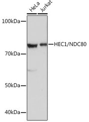 HEC1/NDC80 Rabbit mAb