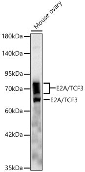 E2A/TCF3 Rabbit mAb
