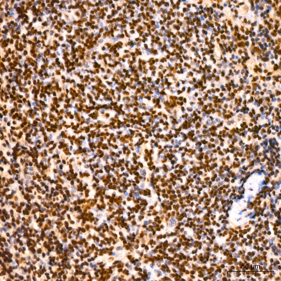 LIM kinase 1(LIMK1) Rabbit mAb