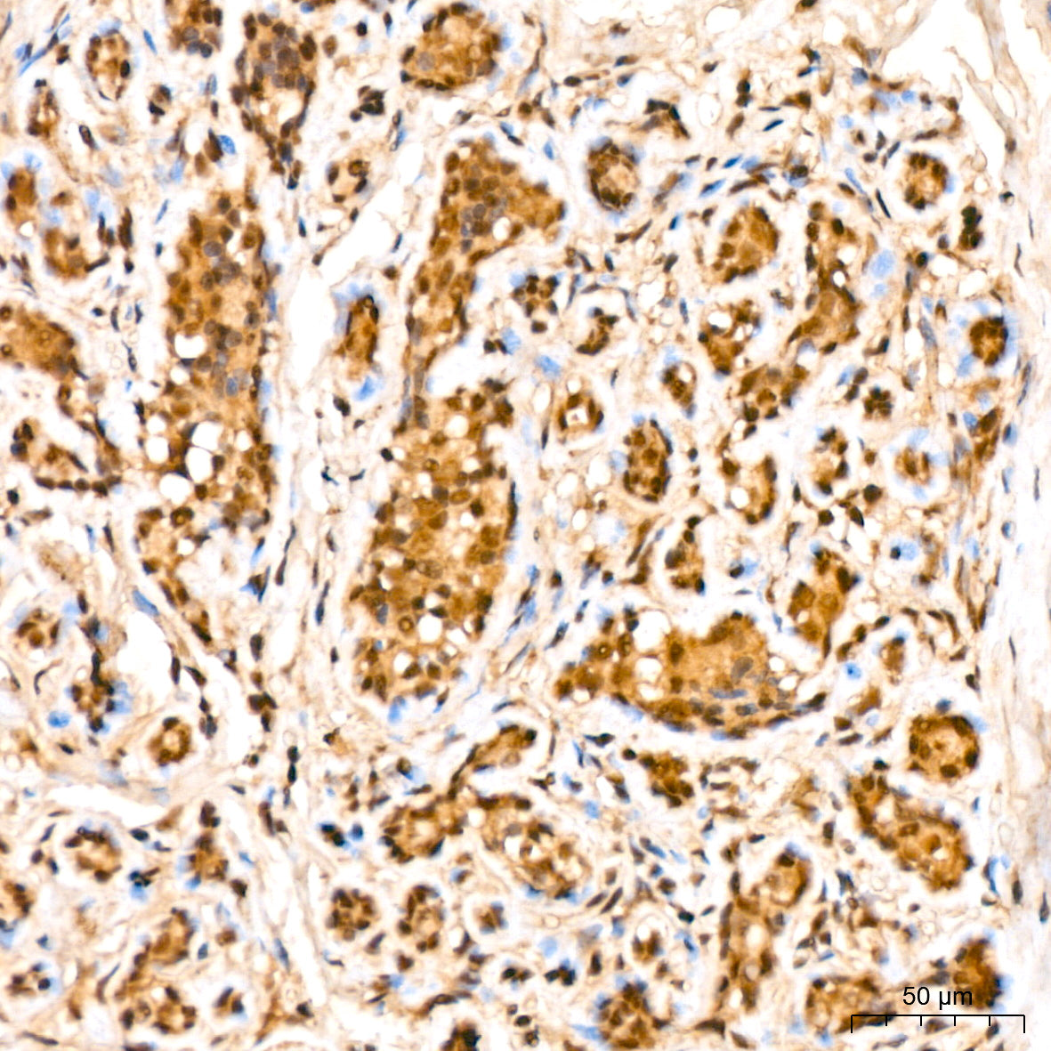 LIM kinase 1(LIMK1) Rabbit mAb