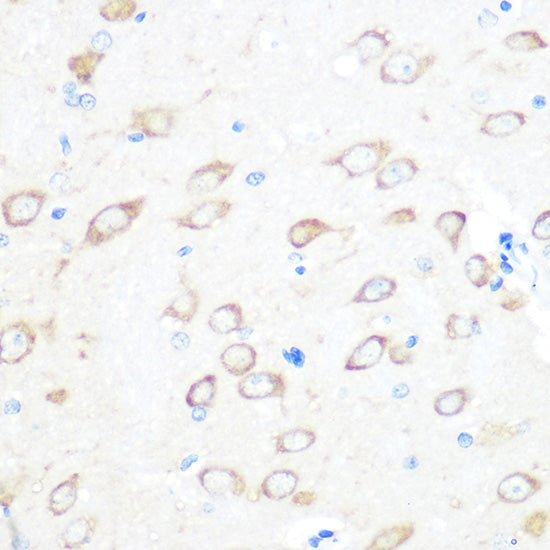 TCTP/TPT1 Rabbit mAb