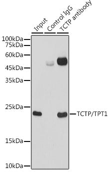 TCTP/TPT1 Rabbit mAb