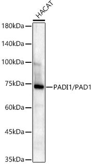 PADI1/PAD1 Rabbit mAb