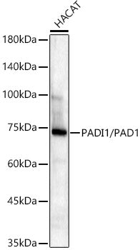 PADI1/PAD1 Rabbit mAb