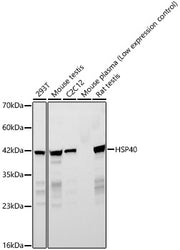 HSP40 Rabbit mAb