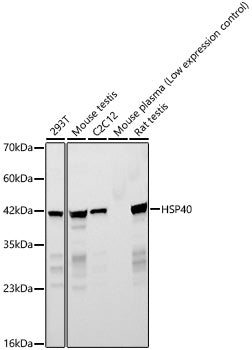 HSP40 Rabbit mAb