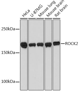 ROCK2 Rabbit mAb