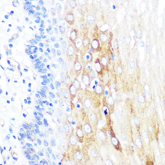 ROCK2 Rabbit mAb
