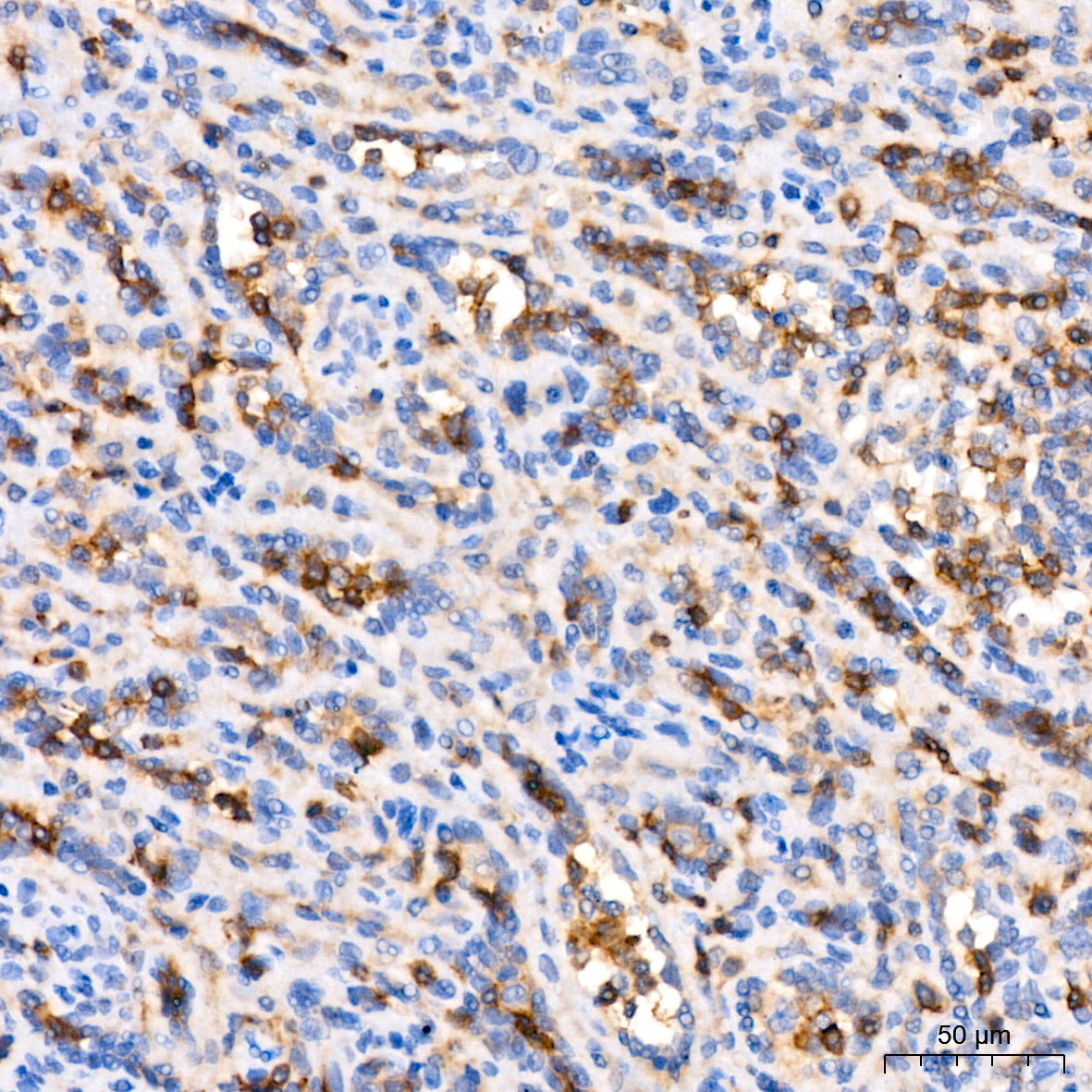 CD11a Rabbit mAb