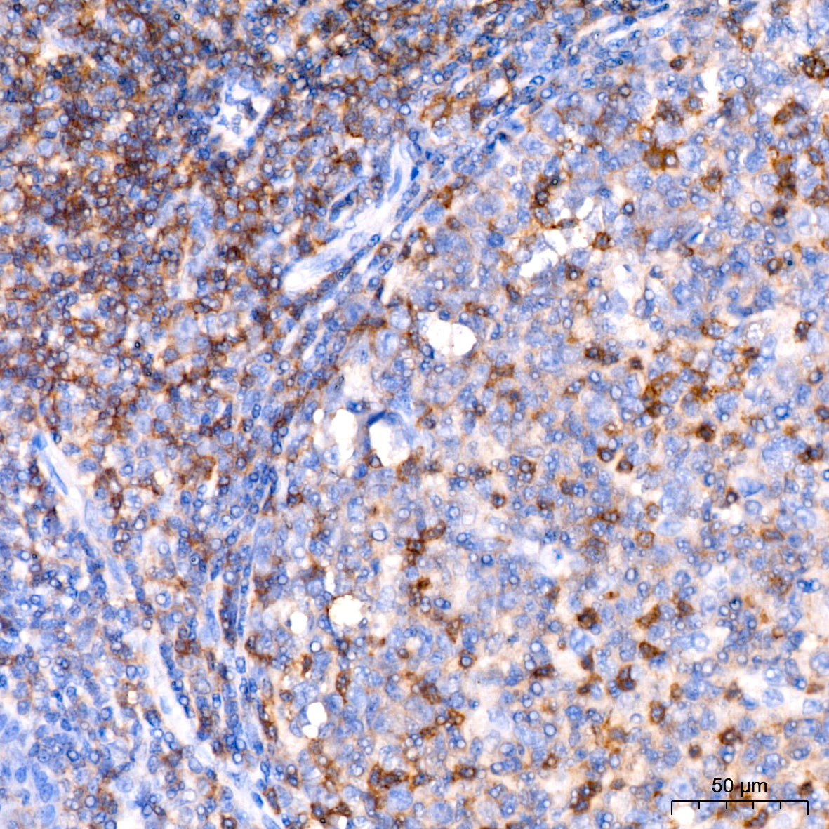 CD11a Rabbit mAb