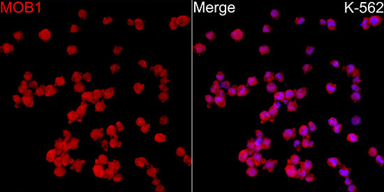 MOB1A/B Rabbit mAb