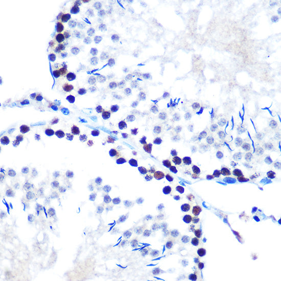 mSin3A Rabbit mAb