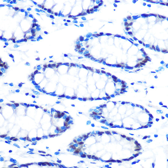 mSin3A Rabbit mAb