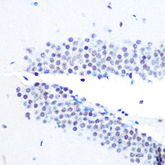 mSin3A Rabbit mAb