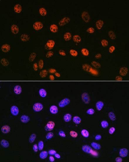 mSin3A Rabbit mAb
