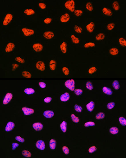 mSin3A Rabbit mAb