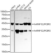 hnRNP E2/PCBP2 Rabbit mAb