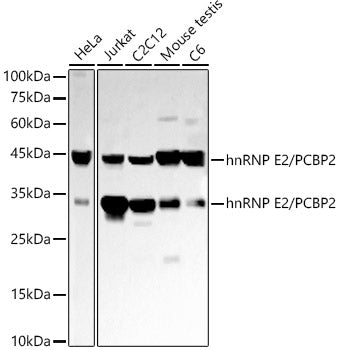 hnRNP E2/PCBP2 Rabbit mAb