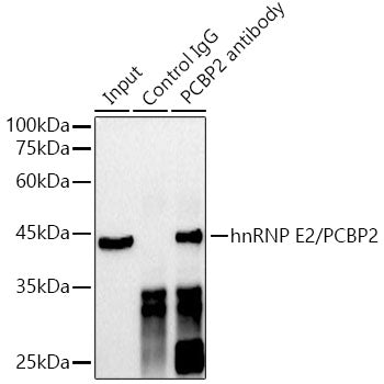 hnRNP E2/PCBP2 Rabbit mAb