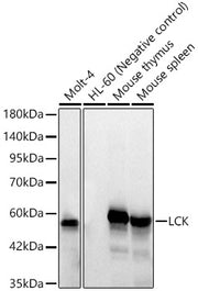 LCK Rabbit mAb