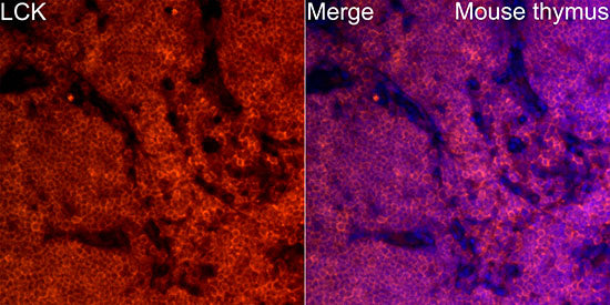 LCK Rabbit mAb