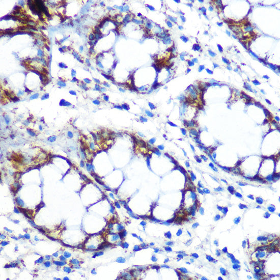 Peroxiredoxin 3 (PRDX3) Rabbit mAb