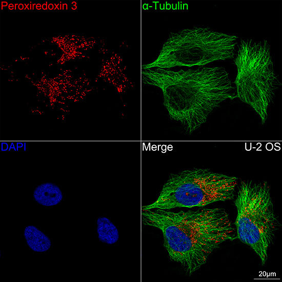 Peroxiredoxin 3 (PRDX3) Rabbit mAb