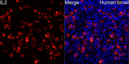 IL2 Rabbit mAb