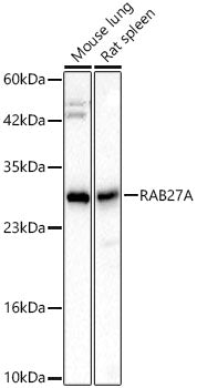 [KD Validated] RAB27A Rabbit mAb