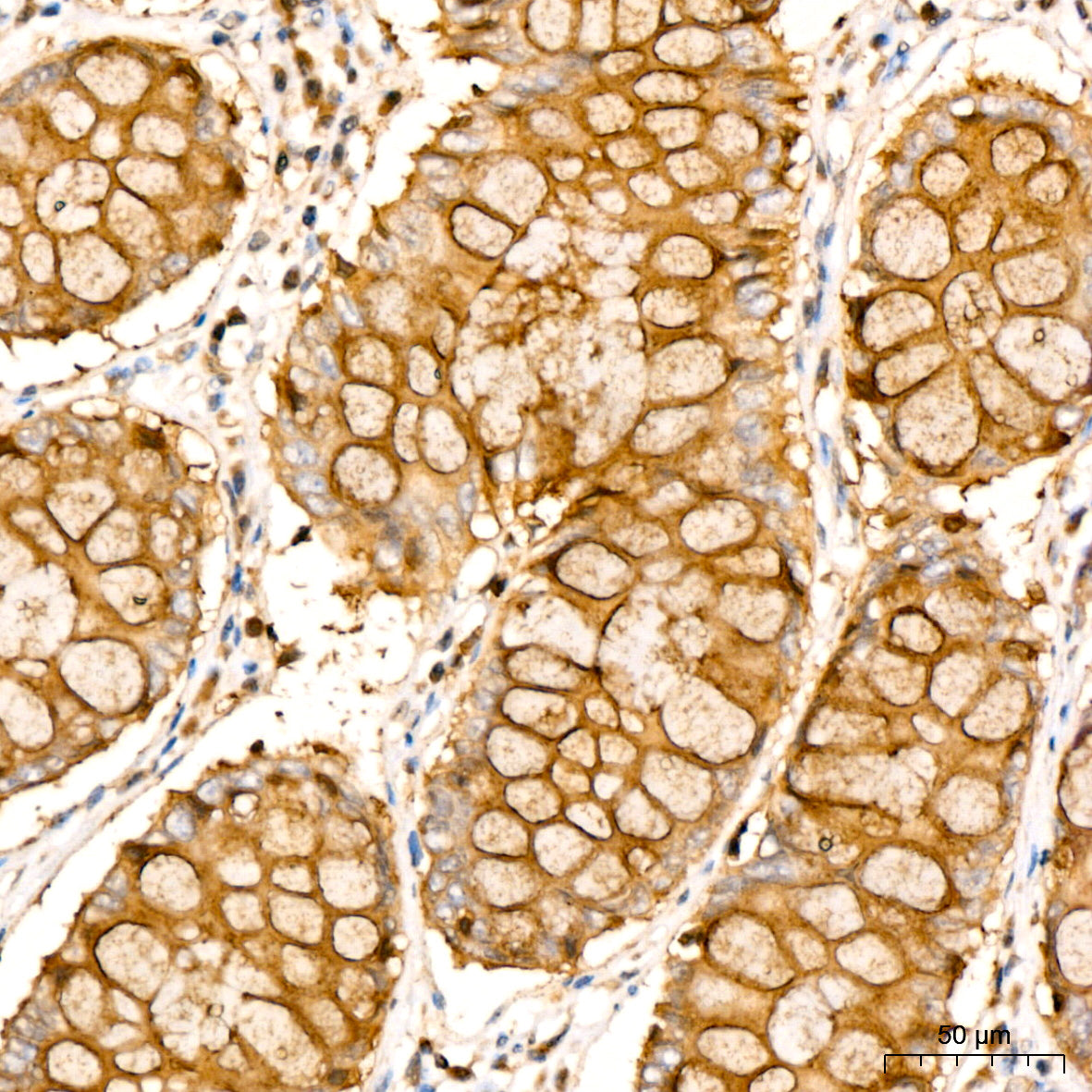 [KD Validated] RAB27A Rabbit mAb