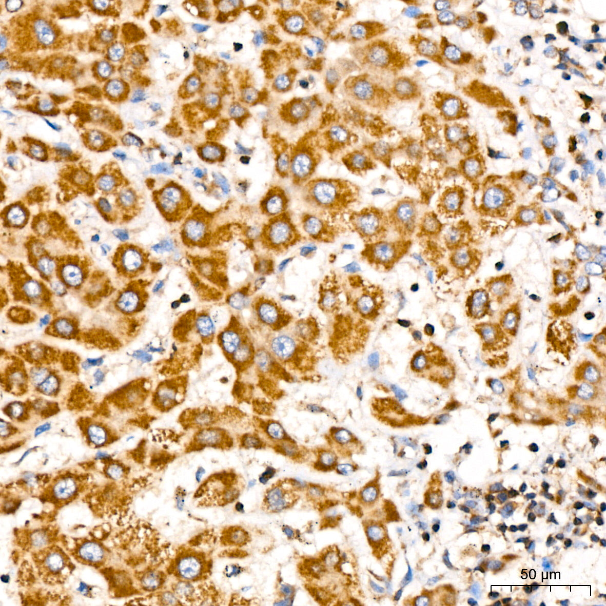 [KD Validated] RAB27A Rabbit mAb