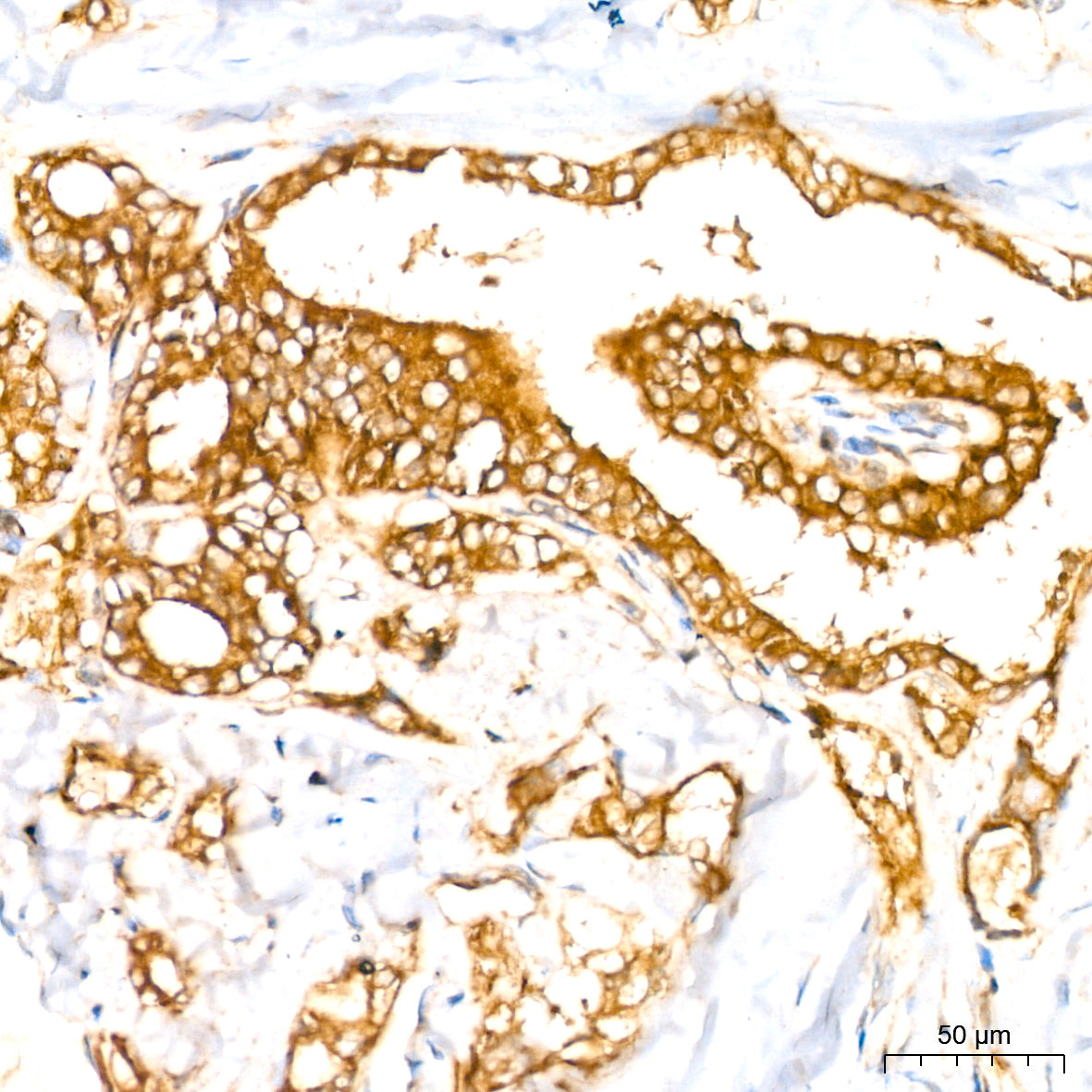[KD Validated] RAB27A Rabbit mAb