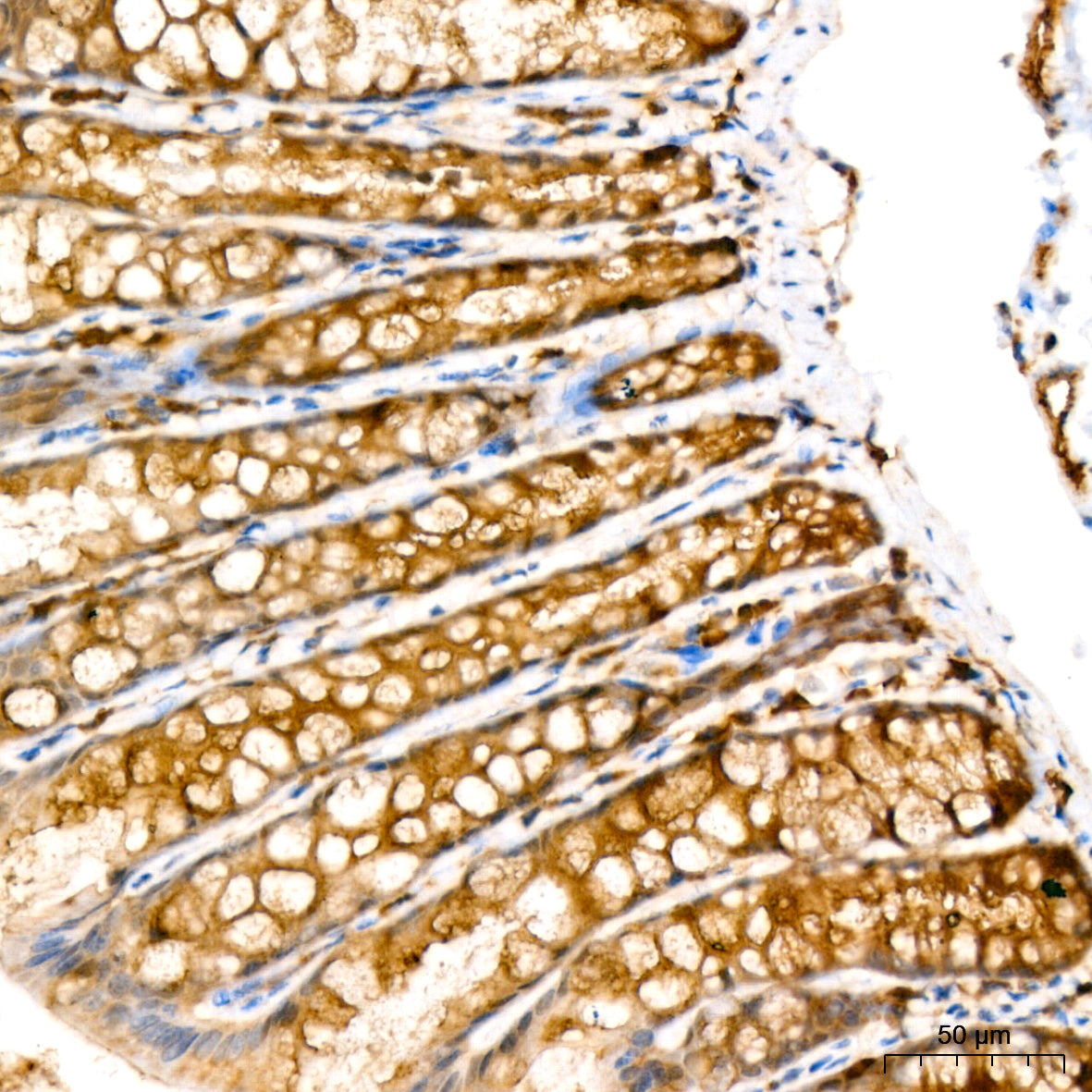 [KD Validated] RAB27A Rabbit mAb