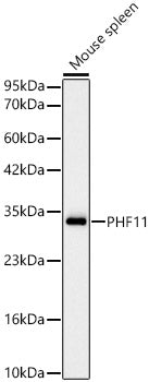 [KD Validated] PHF11 Rabbit mAb