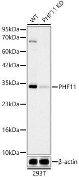 [KD Validated] PHF11 Rabbit mAb