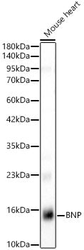 BNP Rabbit mAb