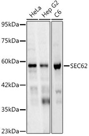 SEC62 Rabbit mAb