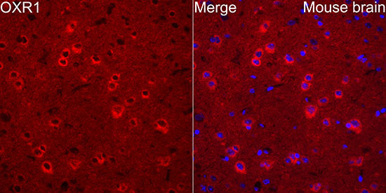 OXR1 Rabbit mAb