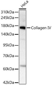 Collagen IV Rabbit mAb