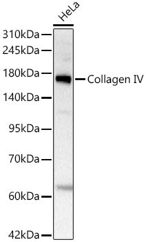 Collagen IV Rabbit mAb
