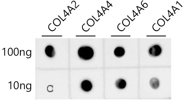 Collagen IV Rabbit mAb