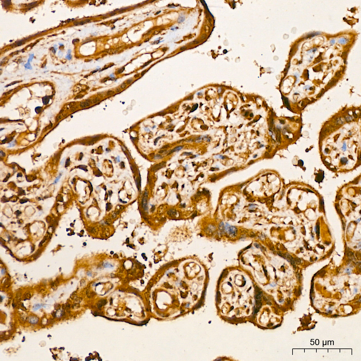 AKT2 Rabbit mAb