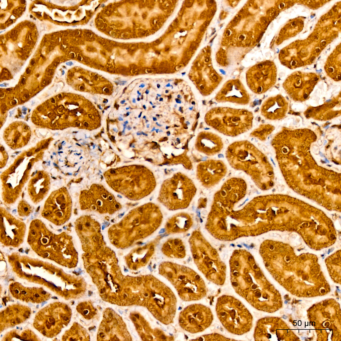 AKT2 Rabbit mAb