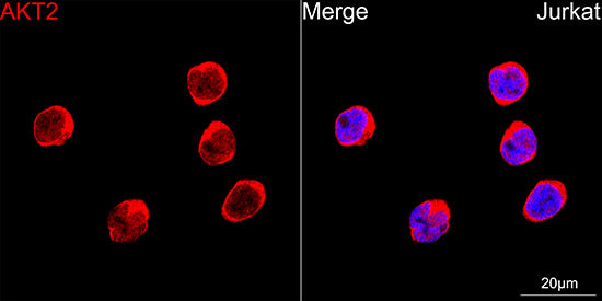 AKT2 Rabbit mAb