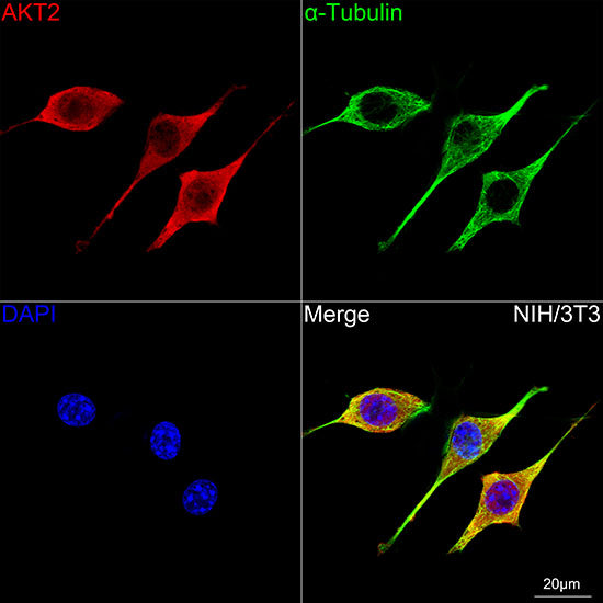 AKT2 Rabbit mAb